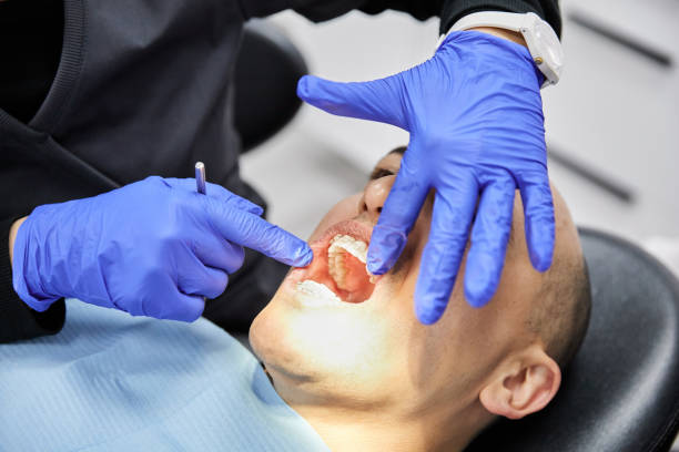 Best Emergency Treatment for Dental Infections or Abscesses in De Leon Springs, FL