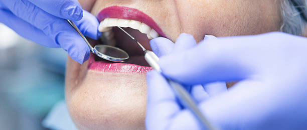 Best Emergency Wisdom Teeth Removal in De Leon Springs, FL